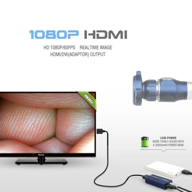 Image 7: Système de caméra endoscopique d'endoscopie HD Portable, ensemble USB 1080P pour Hawk