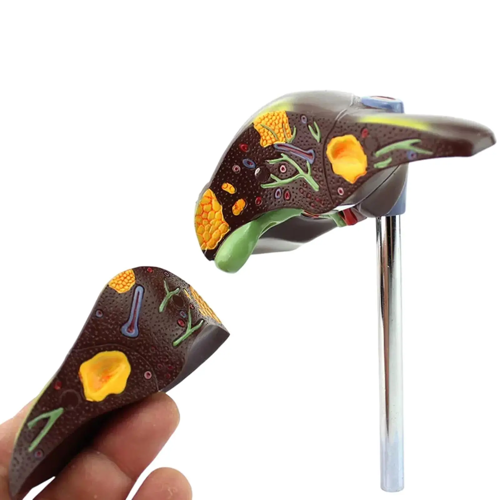 PVC Human Pathological Fatty Liver Cirrhosis Hepatitis Model Medical Teaching Models