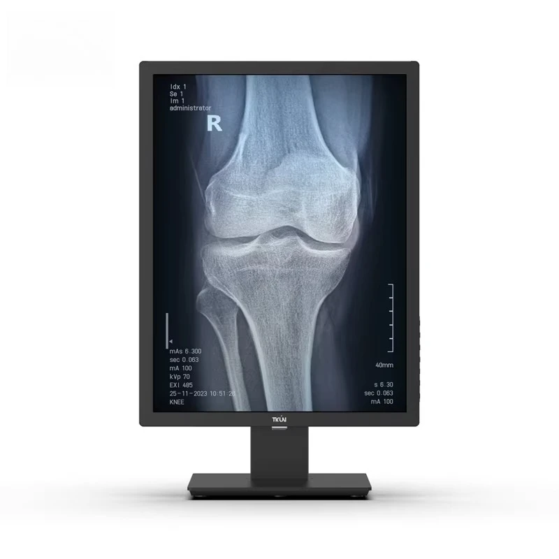 

5MP Medical 21.3Inch Medical Imaging Display 1100nits LCD Medical for Mammography