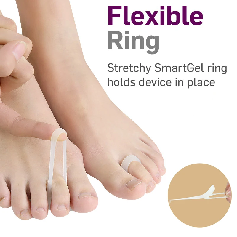 Pexmen 2/4Pcs Gel Hammer Toe Straightener Corrector Toe Separators Toe Straightening Cushion for Mallet and Overlaping Toes