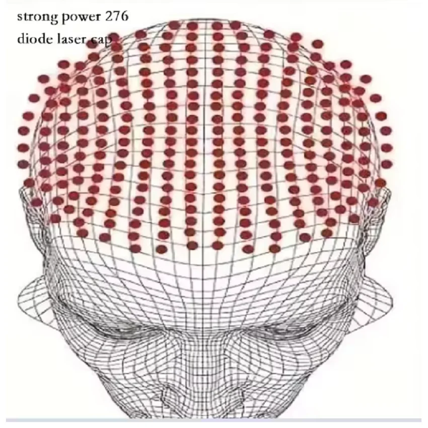 

2760mw durl wave Laser Hair Regrow Helmet Red Light Therapy Hair Growth Cap 276 Laser Treatment Hair Loss Medical Men Women Hat