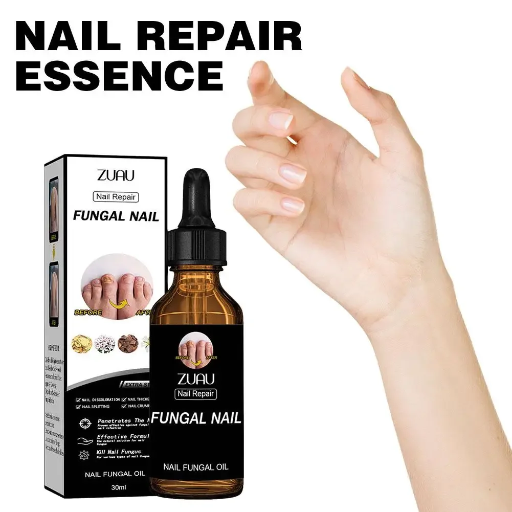 Nail Fungals Renewal Nail Repair Liquid for Discolored Thickened Crumbled Nails Nail Fungals for Discolored Broken Cracked