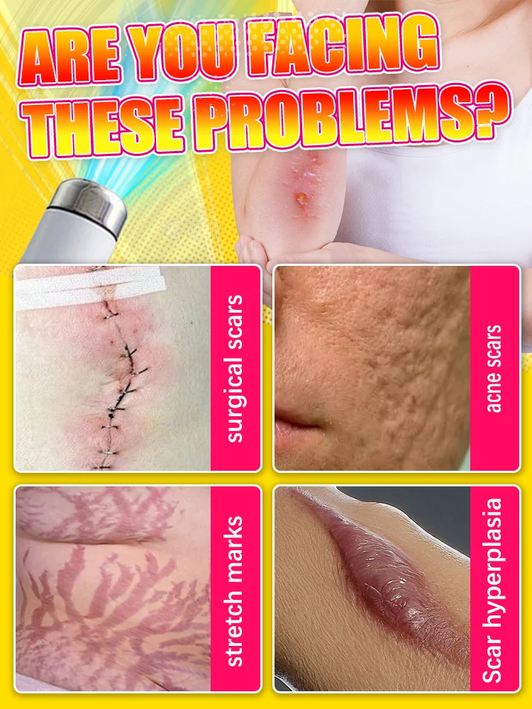 Reparar rapidamente a pele, ferramenta de cuidados com as cicatrizes mais vendida.