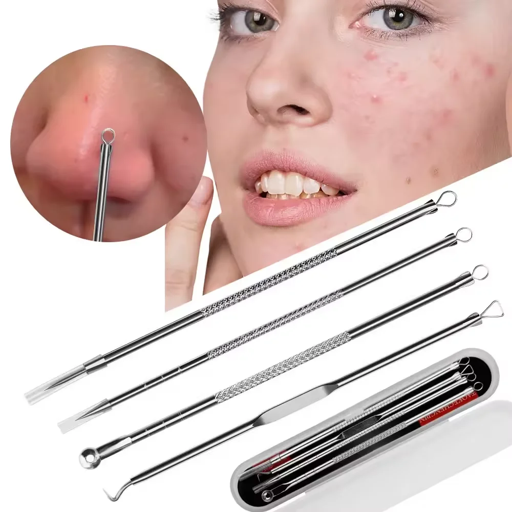 Comédon de points noirs d'acné, dissolvant de boutons et de imperfections, soins de la peau pour femmes, beauté, traitement de l'acné, nettoyeur de pores, crochet à aiguille, 4 pièces