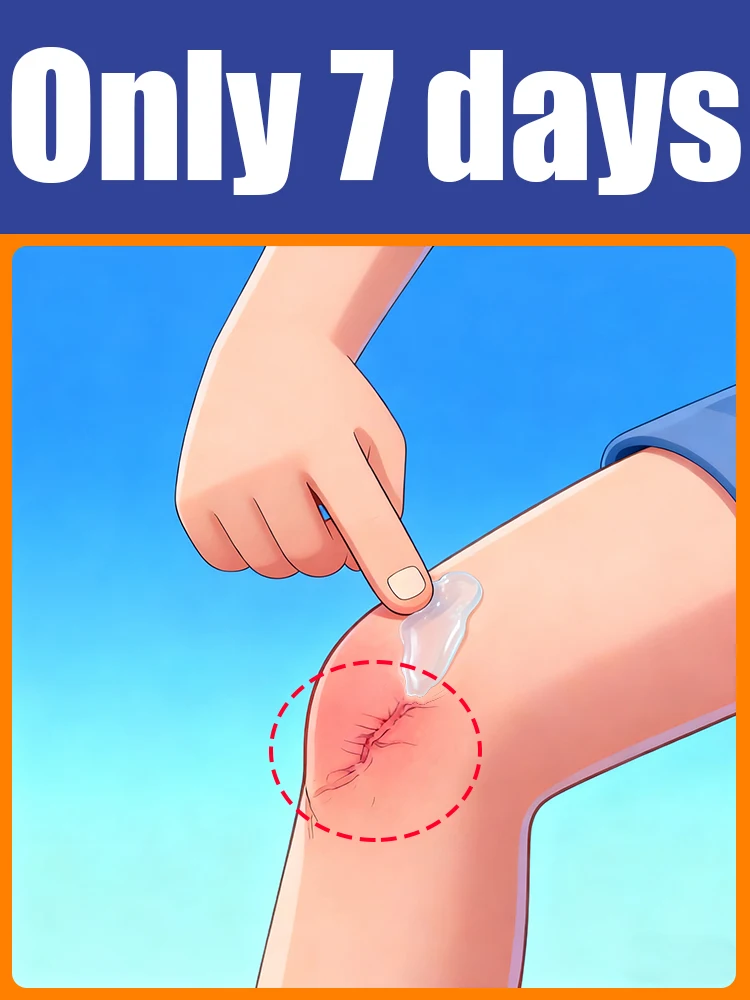 2025 قل وداعاً للندبات ومشاكلك في 7 أيام