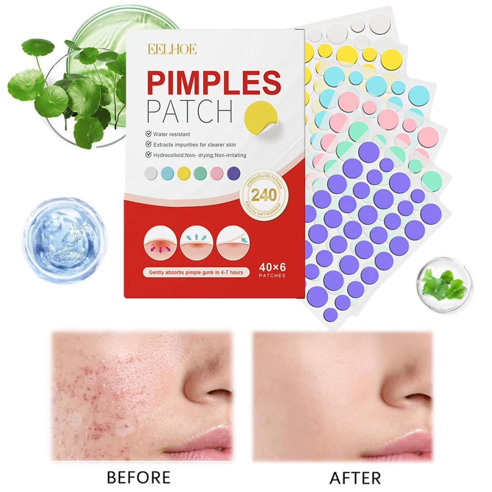 240pcs Pimple Patches Salicylic Acid Tea Tree Hydrocolloid Acne Patches Cute Star Pimple Patches for Healing Zit Patch