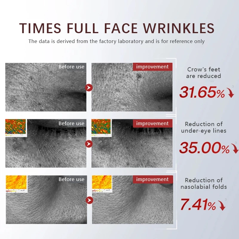 جهاز صغير HIFU بالموجات فوق الصوتية EMS جهاز تجميل الوجه مكركرنت لشد العناية بالبشرة أداة مضادة للتجاعيد #4