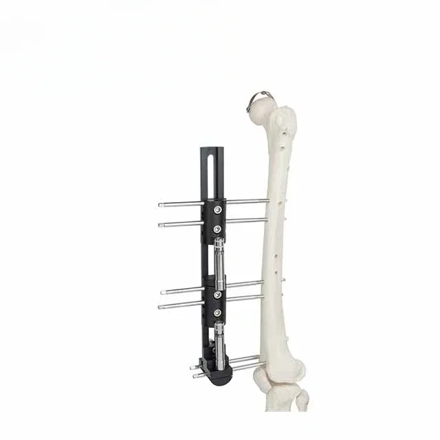 Orthopedic external fixation frame