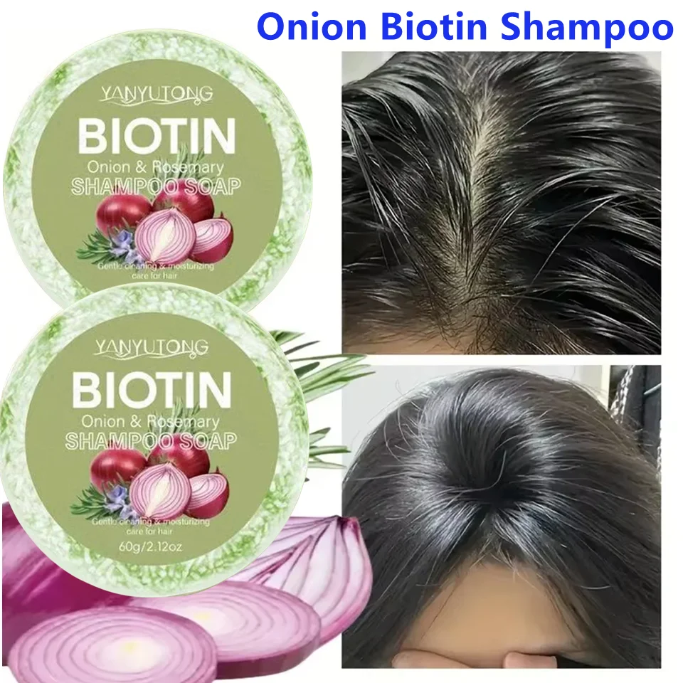 

1/2/3Pcs Onion Rosemary Shampoo Soap, Handmade Soap Oil Control And Dandruff Removal Soap For Both Men & Women