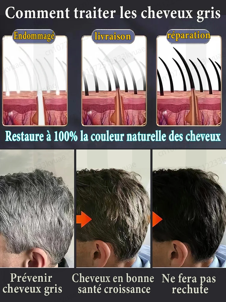 Image 4: Essence anti-blanchissante naturelle pure, élimine les cheveux blancs et noircit les cheveux dès les racines