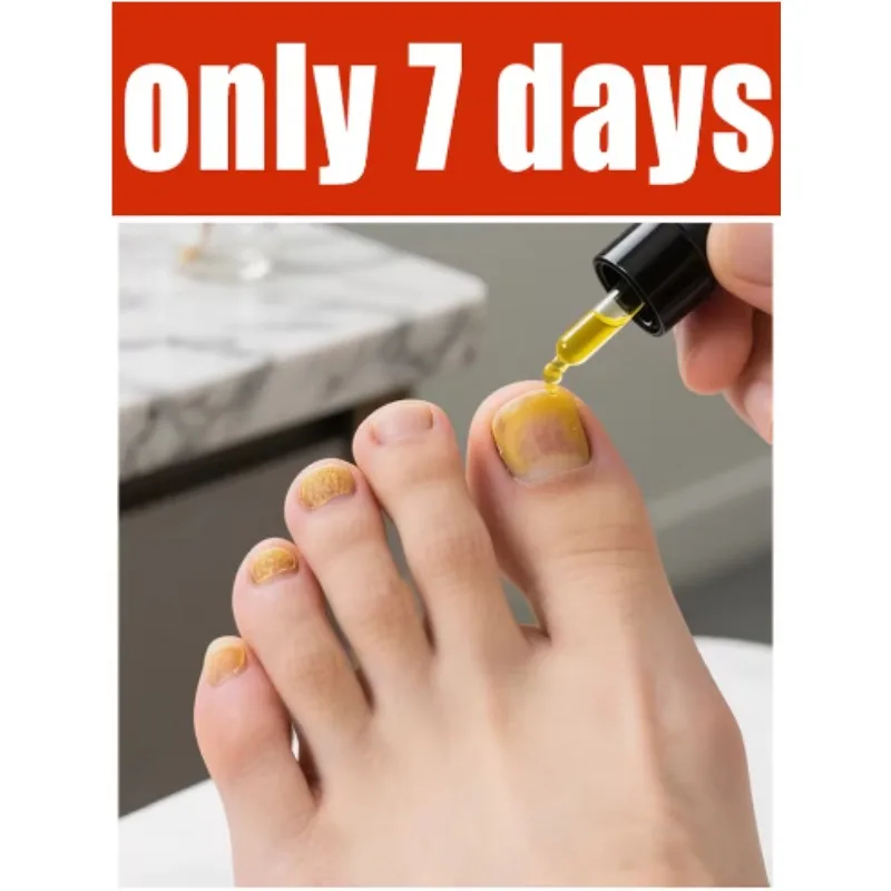 

Rejuvenator - Fungus Prevention Technology - Adjustable Control & Safety Sensor 26