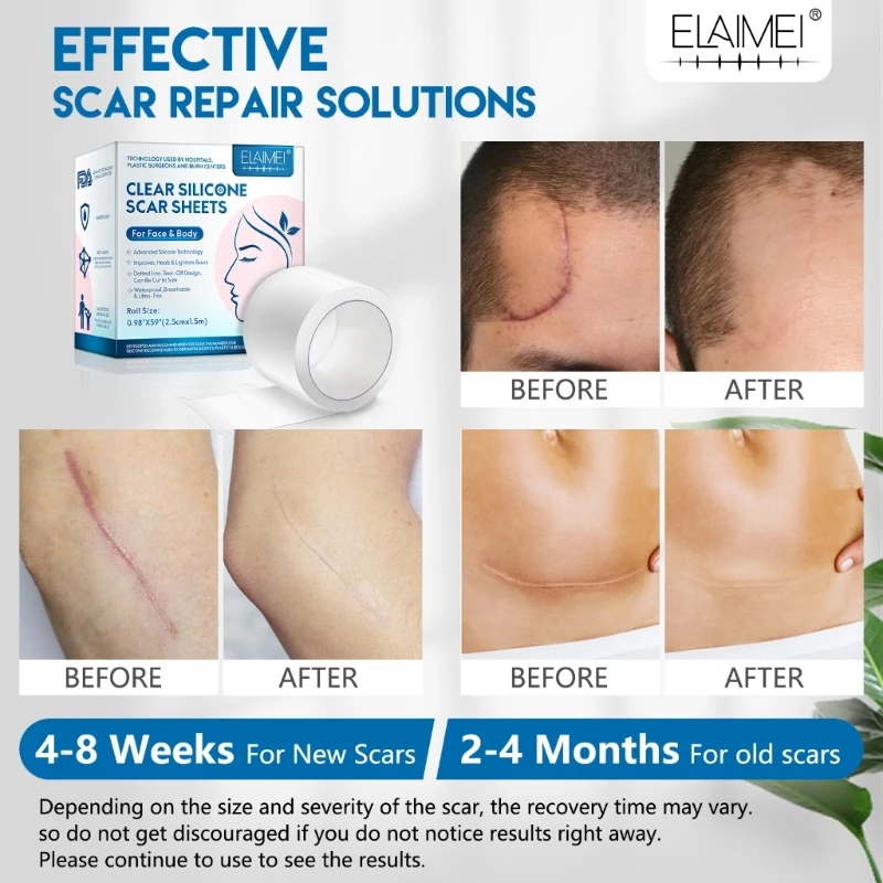 Phẫu thuật sinh mổ hiệu quả Gel Silicone Loại bỏ sẹo Tấm trị liệu Miếng dán trị mụn Chấn thương Đốt cháy Da phục hồi