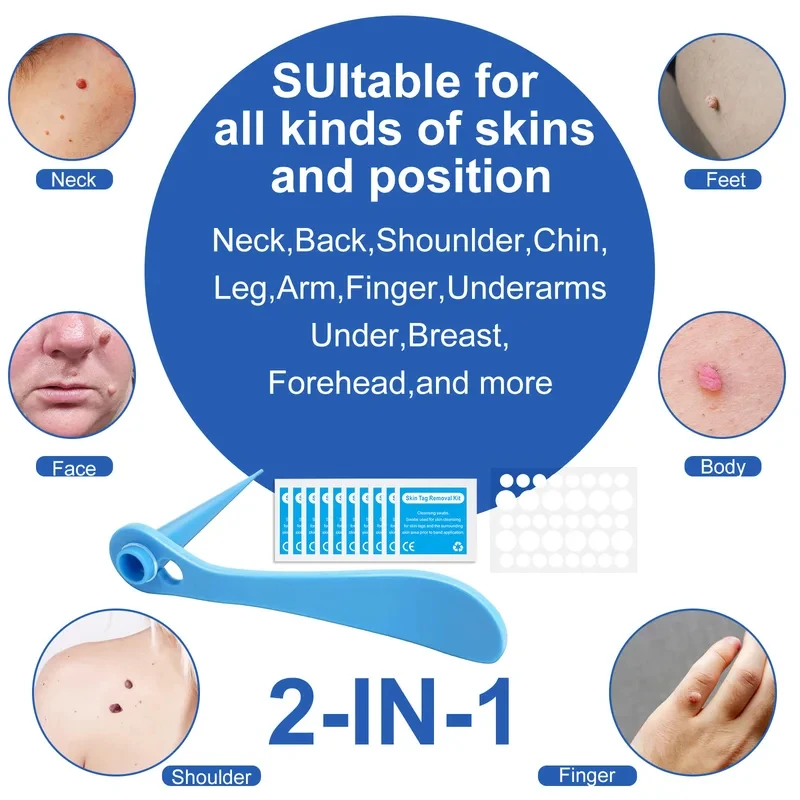 2 In 1 Auto Skin Tag Remover Kit Painless Mole Wart Removal Tool 2-9mm Micro Treatment Skin Care Equipment 4