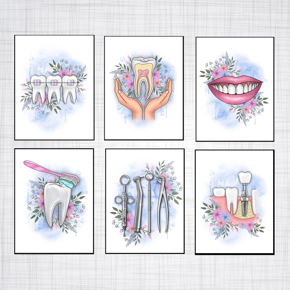 Tooth Implant Canvas Wall Painting Dental Art Poster Dentist Anatomy Prints Medical Wall Art Pictures Hospital Clinic Decoration