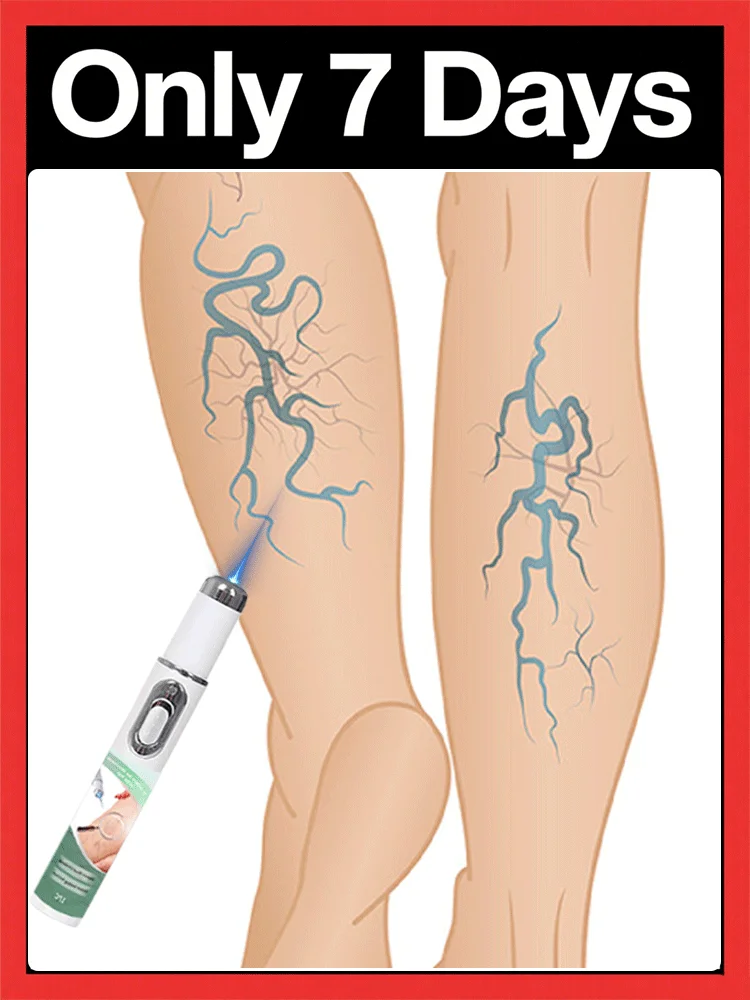 

Leg vein repair light, leg vein patch, deformed and damaged, body care, 2025