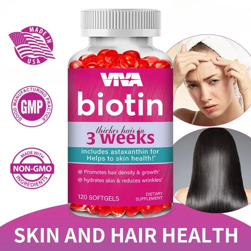 مكمل البيوتين - يحتوي على أستازانتين لتعزيز نمو الشعر، وترطيب البشرة، وتقليل التجاعيد، وتعزيز البشرة الصحية