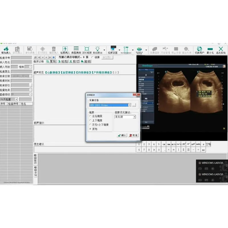 2860 بطاقة الحصول على معلومات الرسومات صندوق اكتساب محطة العمل الطبية بالموجات فوق الصوتية يدعم WIN10