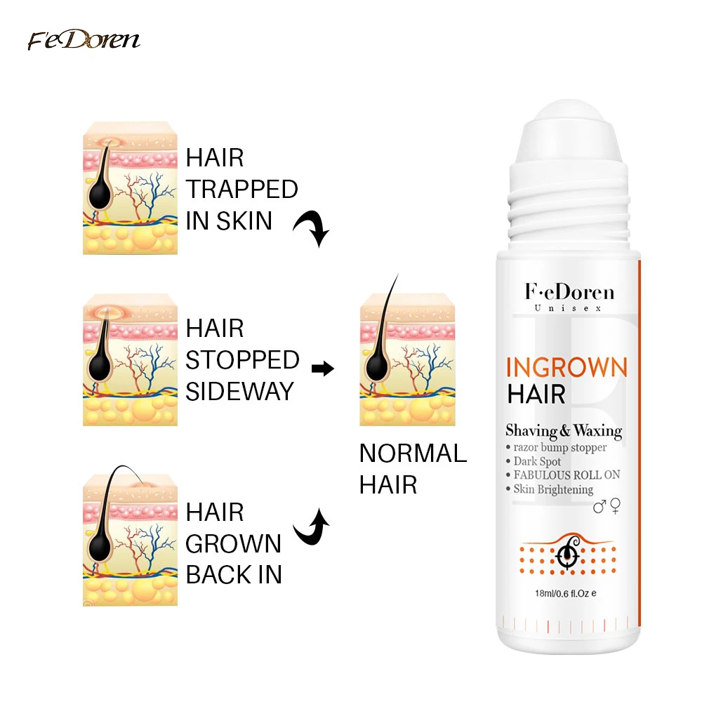 Razor Bumps Removal Solution Ingrowns Hair treatment Kit After Shave Repair Dark Spot Reduce Redness Serum for vanish PFB Pimple