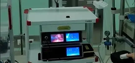 100W Adjus Brightness Medical Endoscopic Light Source Cold Light Source For Endoscopy Surgery Examination Hospital