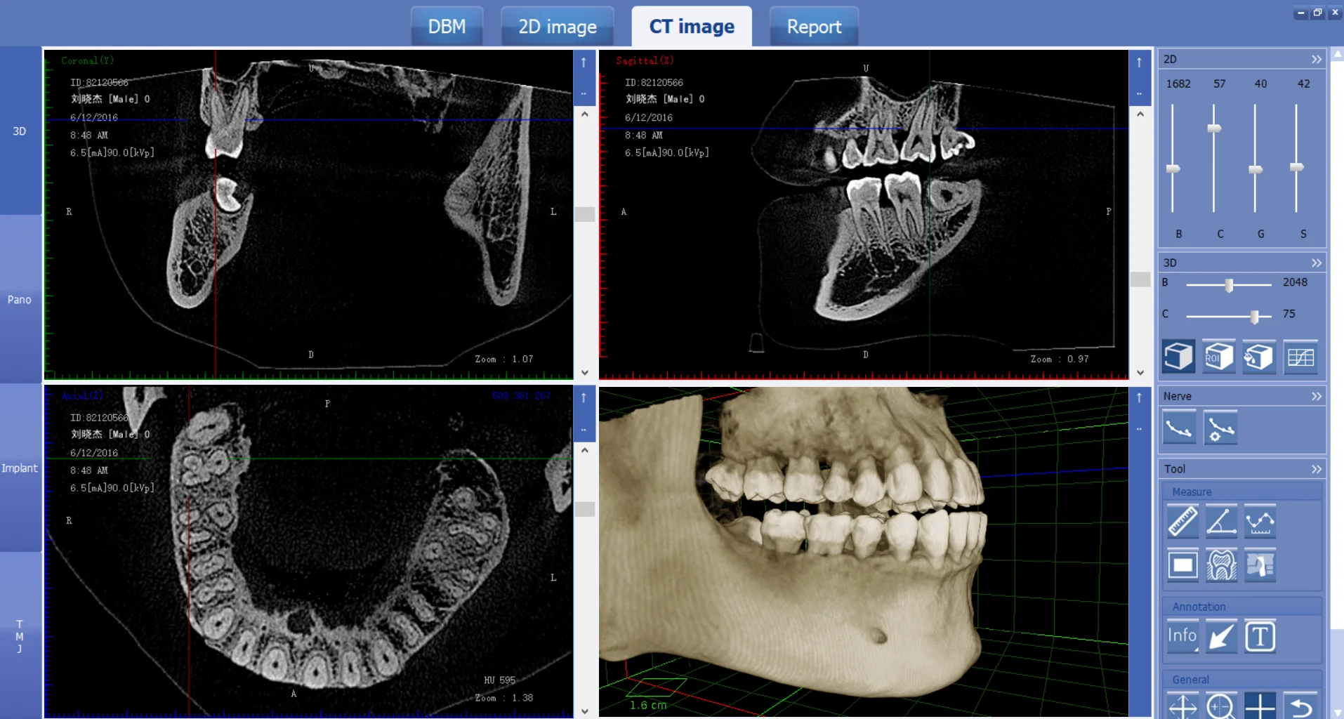 Newest cbct den  tal x ray machine equipments