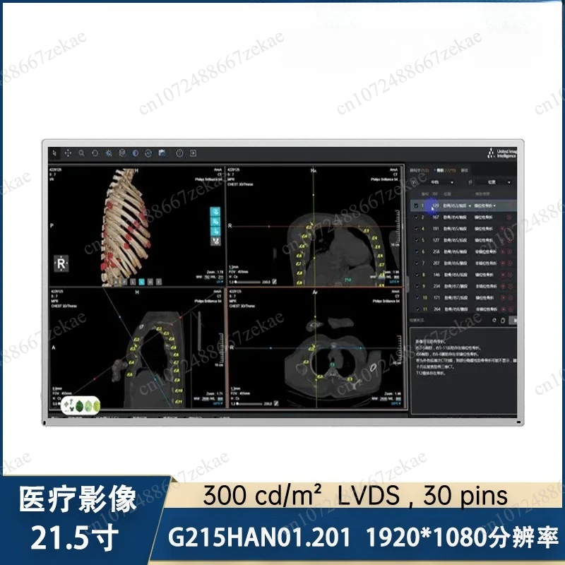 LVDS interface high definition LCD screen G215HAN01.201 21.5 inch special screen for industrial equipment