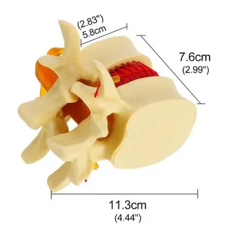 Imagen 2 del producto Modelo de patología de columna humana agrandada y columna lumbar, modelo de demostración de hernia de disco lumbar
