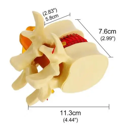 Imagem -02 - Ampliado Modelo Humano e Lombar Ensino Demonstração Disco Lombar
