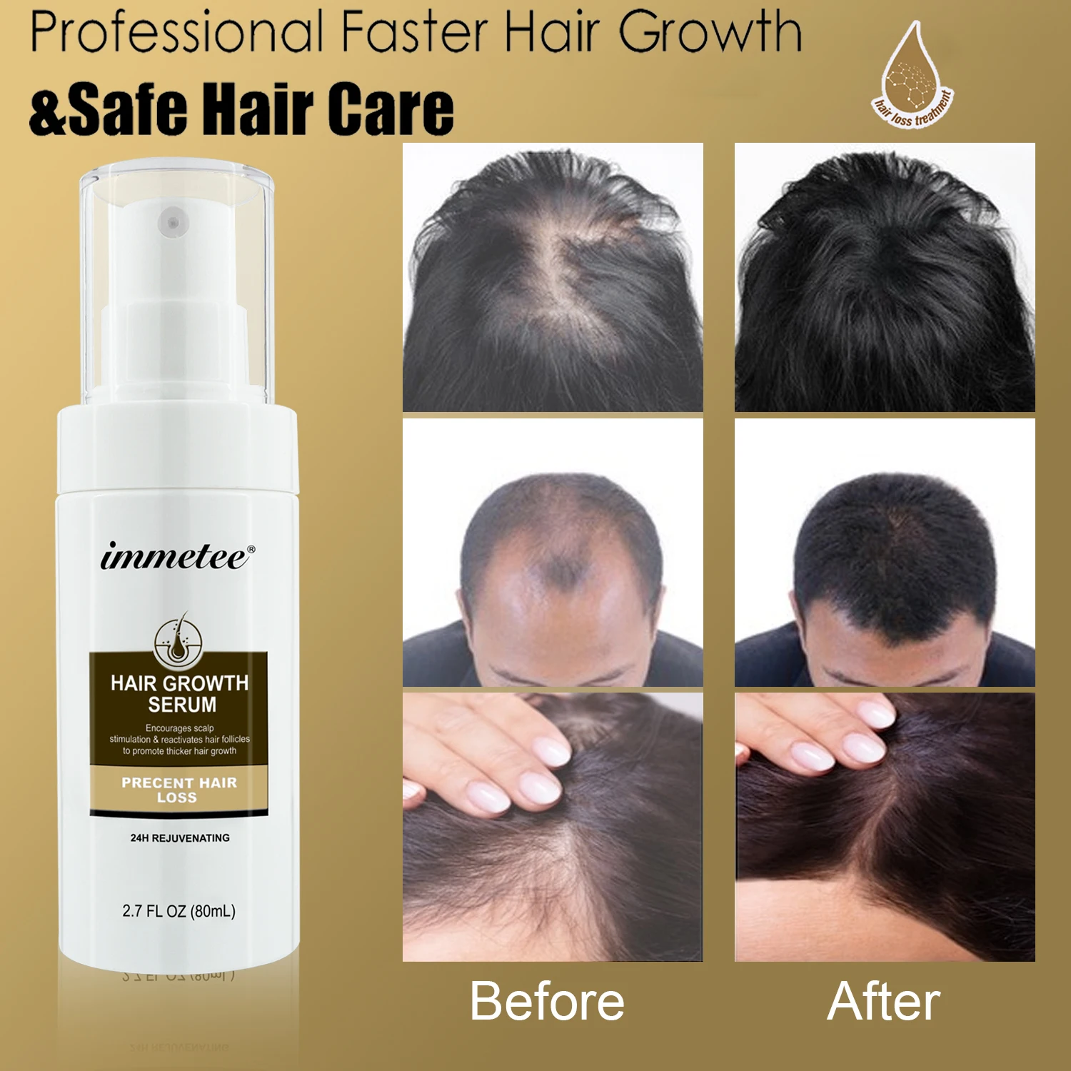 Anti Hair Loss Nourish Help for Hair Growth Longer Thick Hair Regrowth Essence Hair Care Spray Products Prevent Baldness