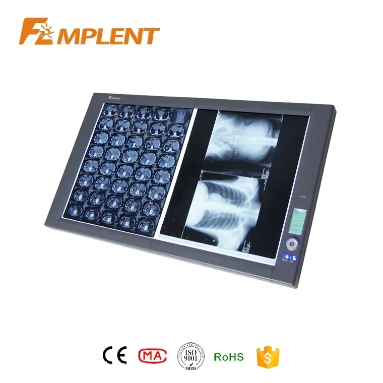 In Stock Mplent Ultra Bright LED Negatoscope X-ray film viewer medical equipment for hospital