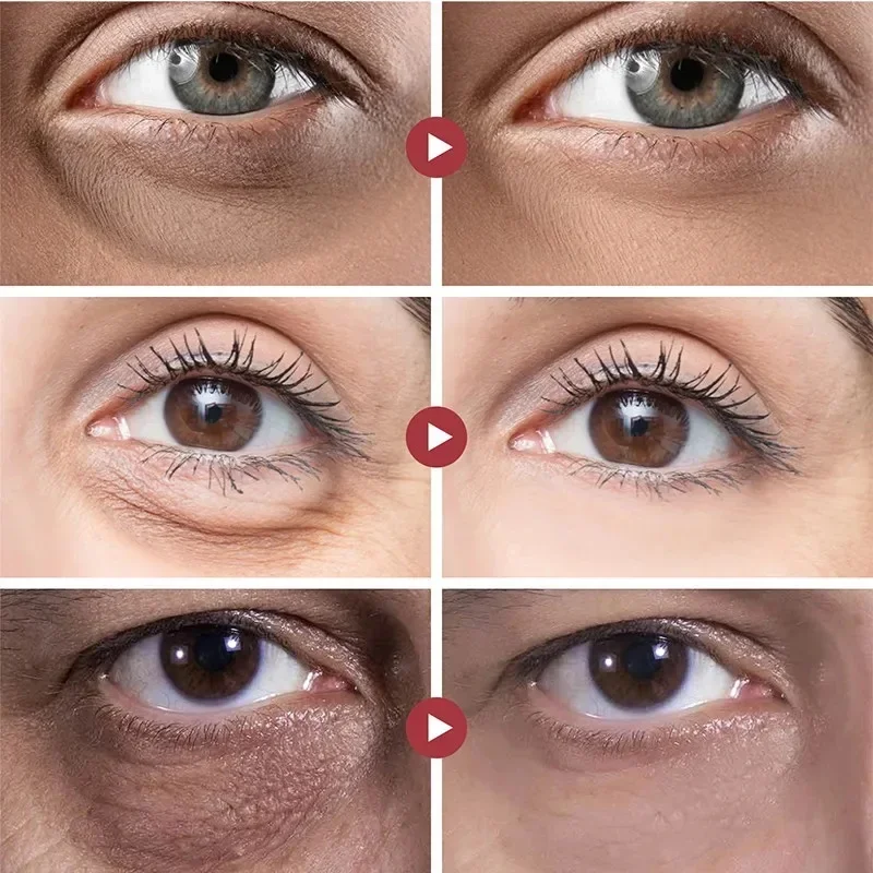 Anti-Rimpel Eye Essence Olie Hydraterende Verstevigende Crème Fleuren Huid Verwijderen Donkere Kringen Oogcrème Vrouwen Ogen Zakken Serumverzorging