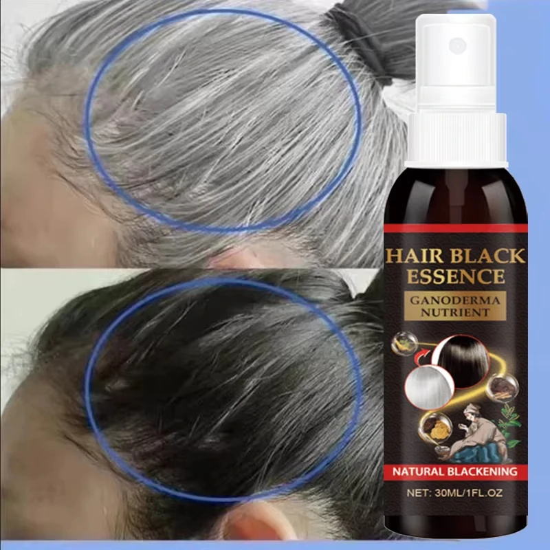 

Убить белые волосы, устраняют седые волосы и восстанавливает натуральную краску волос в течение 7 дней.