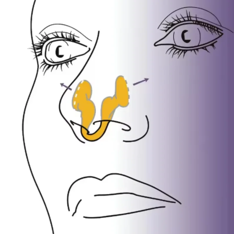 1/3 قطعة جهاز إيقاف الشخير الصغير سيليكون مشبك الأنف المرن مكافحة الشخير لوازم الشخير سدادة مشبك الأنف للرجال والنساء #6