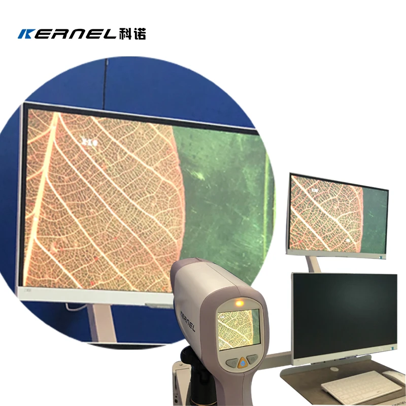 Kernel KN-2200IH CE Approved Digital Video Handheld With Diagnostic Software For Gynecology Clinic Use