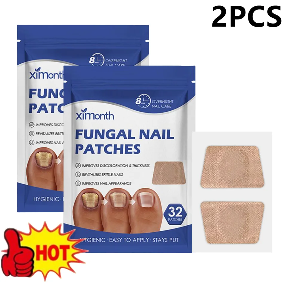 1/2 Beutel Pilznagelbehandlungspflaster Paronychie Anti-Infektion Onychomykosionsentfernung Graue Nagelreparatur Richtiger eingewachsener Nagelaufkleber