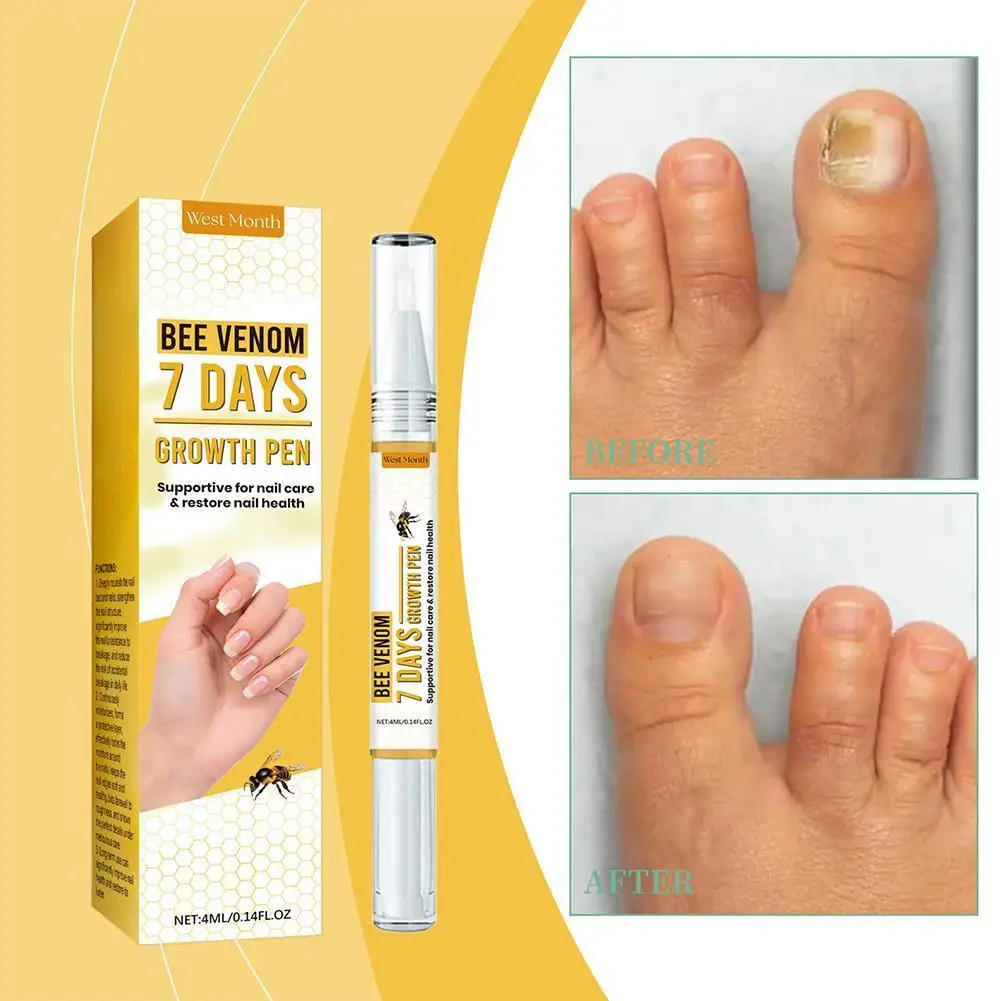  Nail Repair Solution Essence Onychomycosis Anti-Infection Moisturizing Professional Repair Nail Fungus Care Products