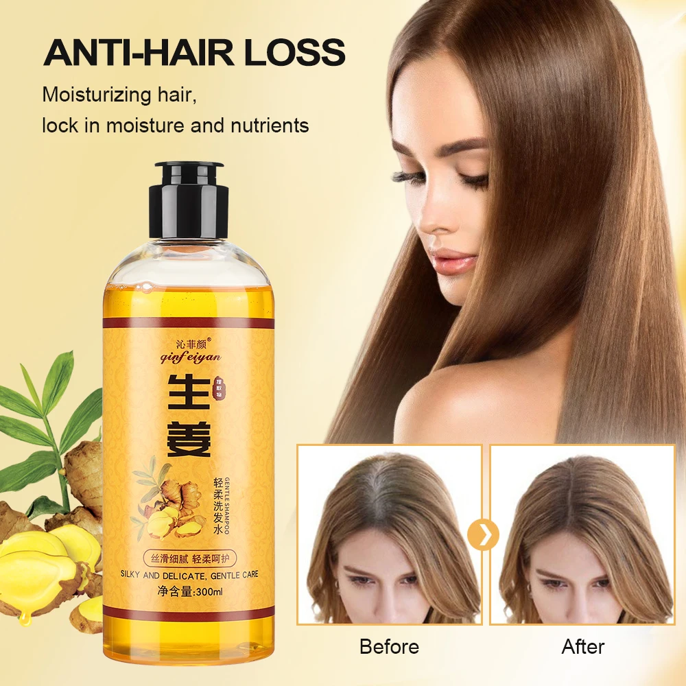 

300ML Ginger Shampoo Moisturizes Nourishes Hair Repairs Damaged Hair Anti-hair Loss Improve Greasy Hair For Men Women Hair Care