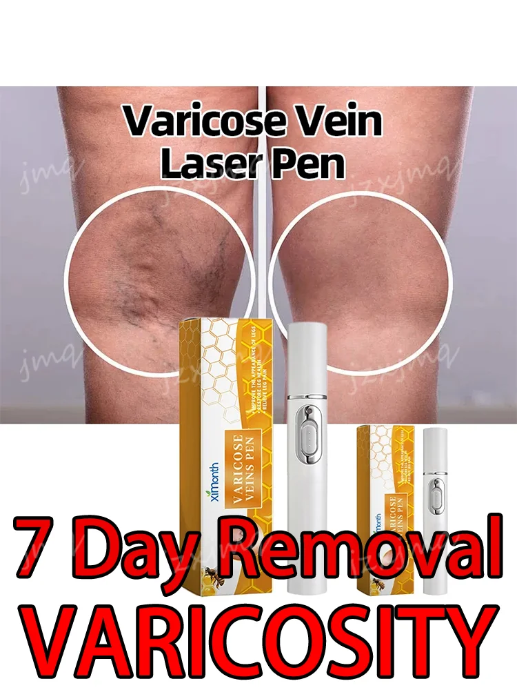 

Blue Light Laser Varicose Veins Pen