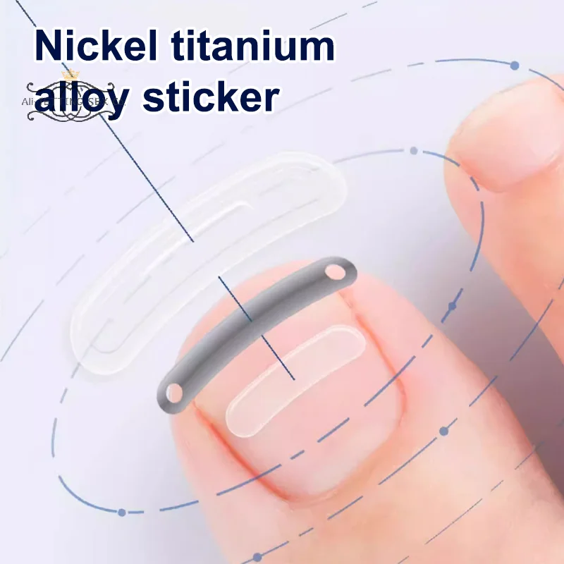 نام أظافر تصحيح نام تو علاج الأظافر رقعة مرنة ملصق استقامة كليب هدفين باديكير أداة العناية بالأظافر