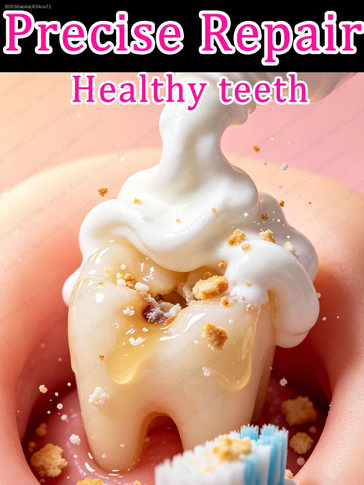 Лечение кариеса A toothpaste that can effectively clean teeth