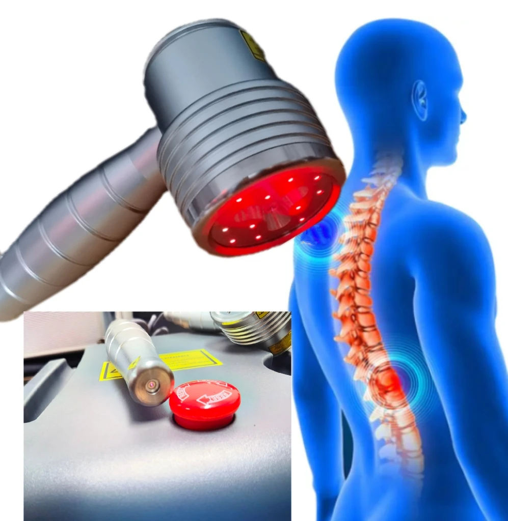 Arthritis Wound Healing 808nm & 650nm Laser Pain Relief Sciatica Heel Spurs Neck Pain Cold Laser Therapy Body Pain