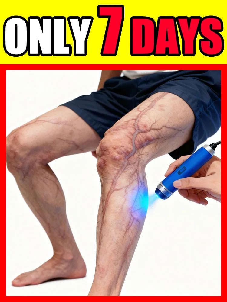 

Самый продаваемый продукт для ухода за ногами на 2025 год: попрощайте в 7-дневные ноги-пауки