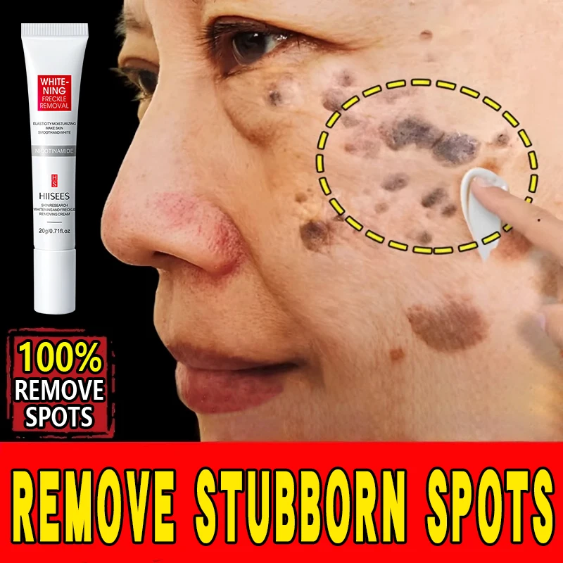 The freckle-removing cream can remove chloasma and freckles, whiten, moisturize, hydrate and fade pigmentation