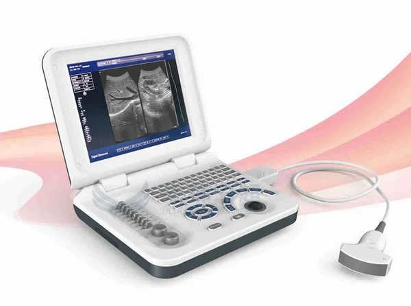 Cheapest and affordable Full Digital Black and White Notebook/Laptop 10 inches Veterinary Ultrasound Scanner factory price