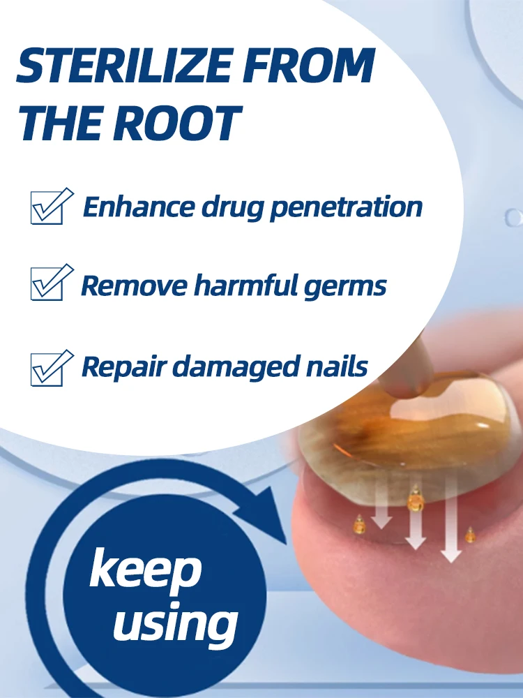 تجديد الأظافر الفطرية يعيد مظهر الأظافر المتغيرة أو التالفة