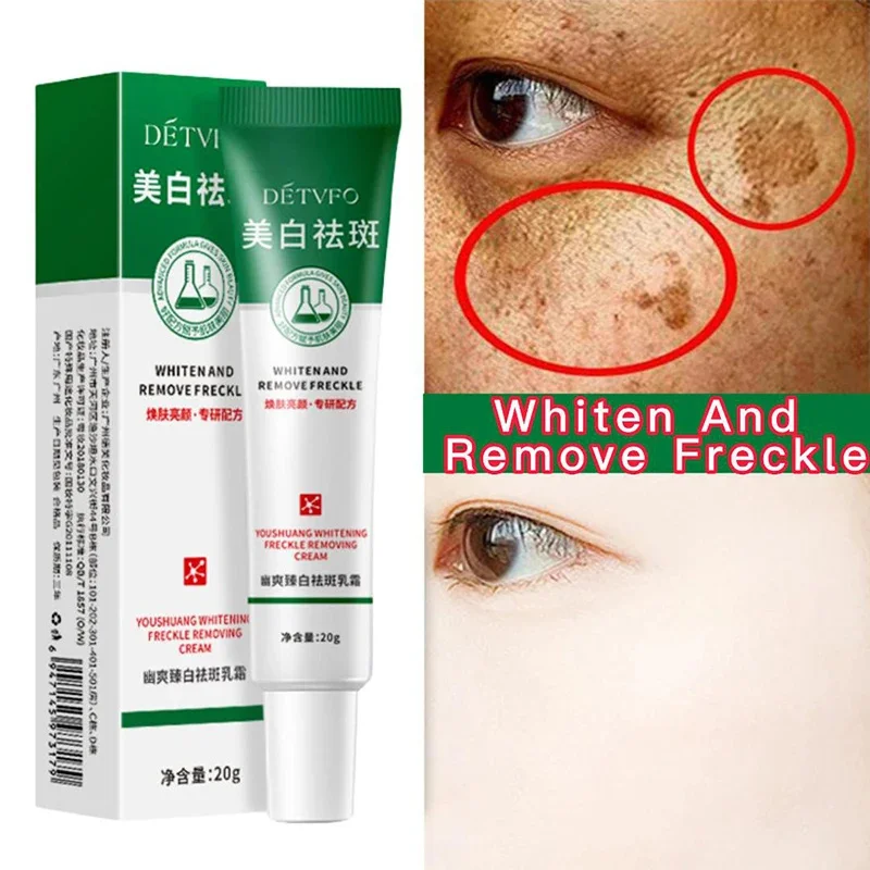 

Dark spot Remover Face Cream Black Age Sun Spots Freckle Fade Melasma Pigmentation Whitening Brighten Skins Face Care Product