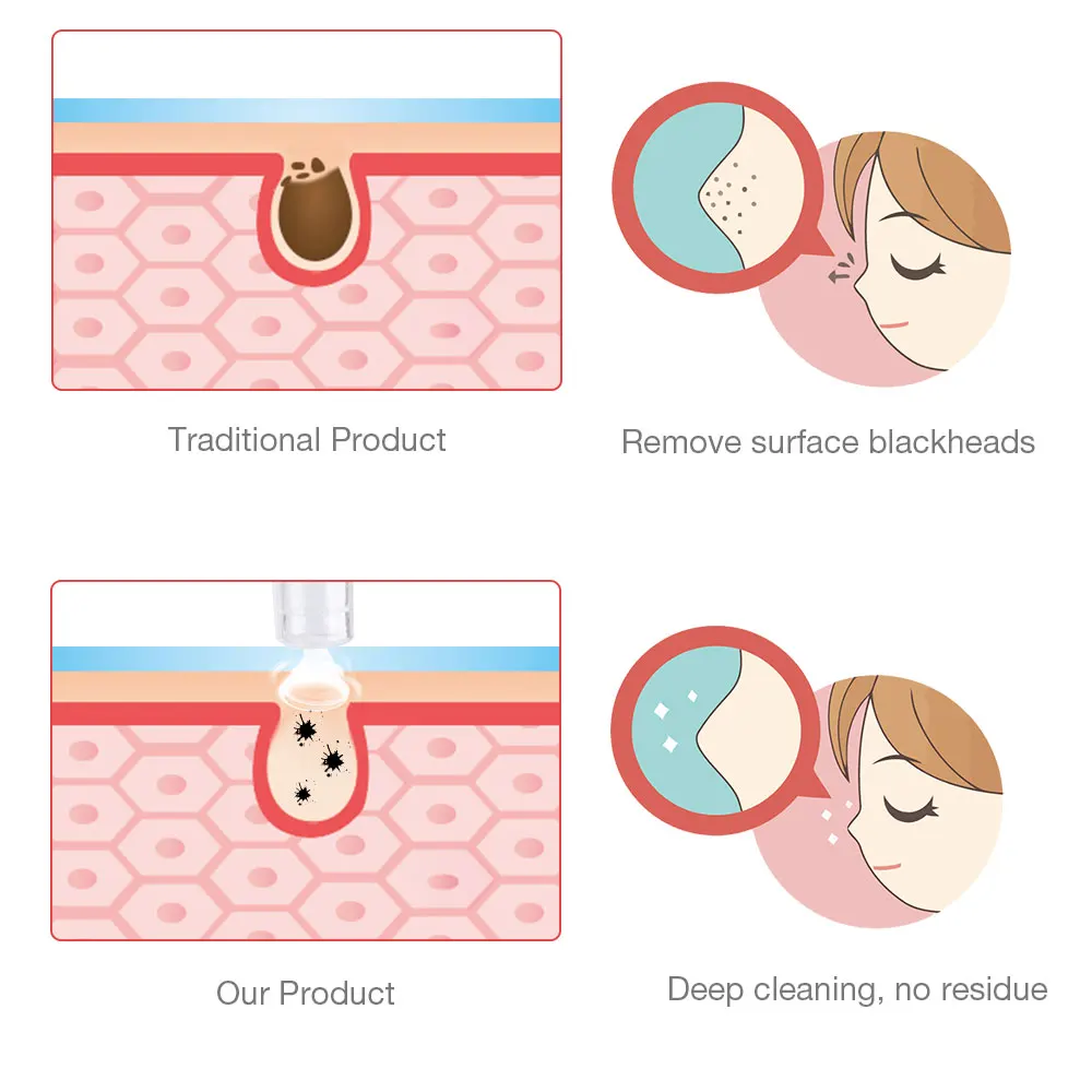 ดิจิตอล Microdermabrasion สูญญากาศ Blackhead Cleaner สิวกำจัดขนทำความสะอาดลึกรูขุมขน Skin Care เครื่องมือ