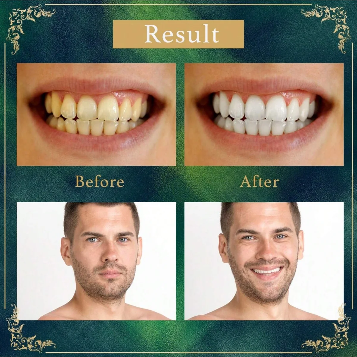 فرشاة أسنان Miswak Sticks - نكهة طبيعية مختومة بالفراغ من نباتات التنظيف العربية الأصلية هدية عصا المضغ #5