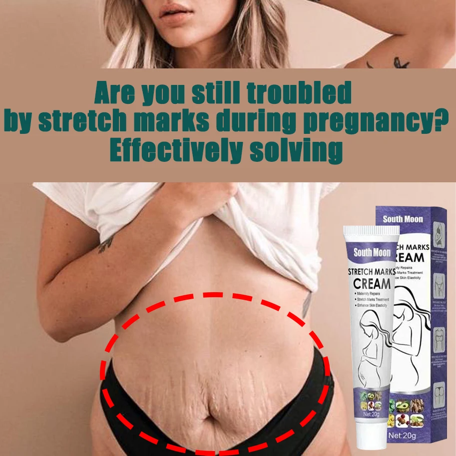 

HOT SALE Stretch Mark Cream Anti-wrinkle Anti-aging Maternal Skin Repair Remove Pregnancy Scar Treatment Body Skin Care