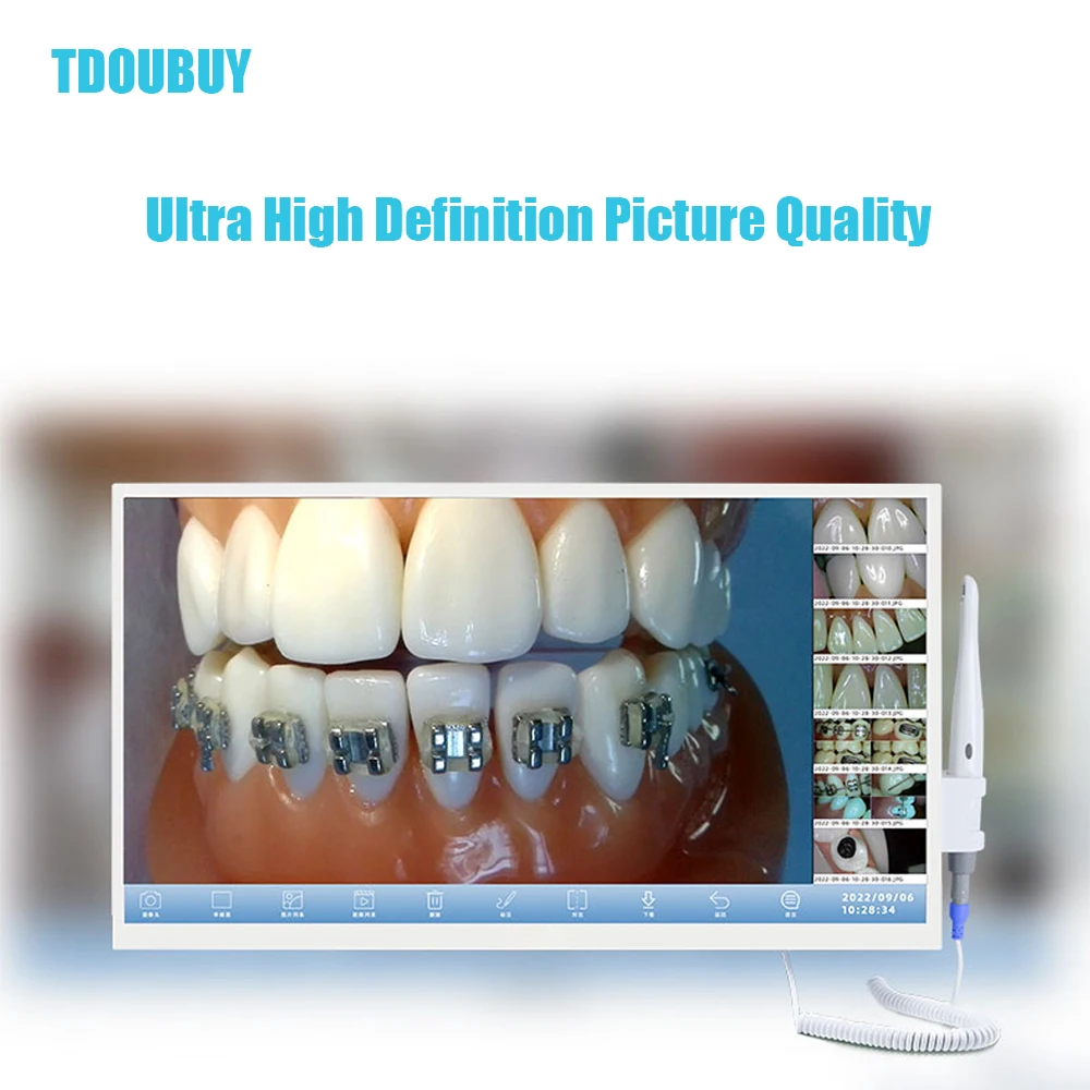TDOUBUY 4K UHD Dentystyczna Kamera Intraoralna - Wodoodporny Ekran Dotykowy IP67 z Certyfikatem CE dla Klinik Dentystycznych/Chirurgii Ustnej