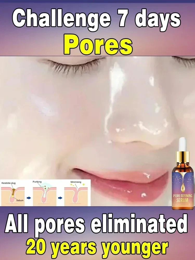 Pore Removal Cleans Nose Blackheads Skin Firming Moisturizing Facial Essence Skin Care